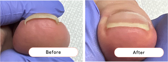 フットケアの様子3