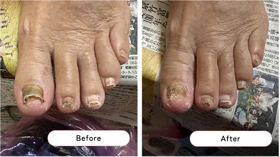 フットケアの様子5